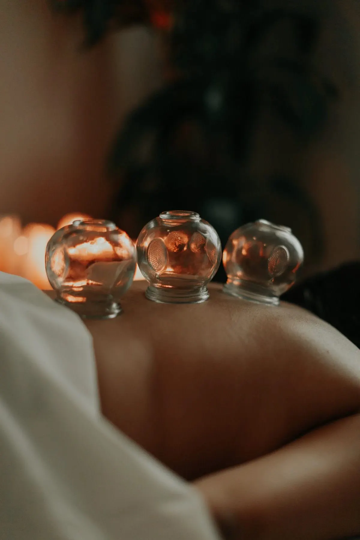 Massage aux ventouses à Strasbourg Neudorf